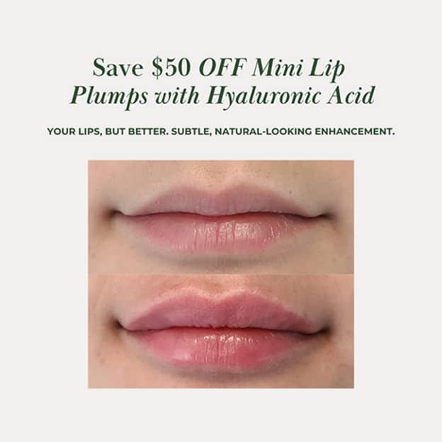 Easter at Therapeutic Aesthetics Mini Lip Plump Promotion