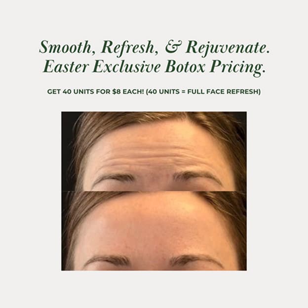 Easter at Therapeutic Aesthetics Botox Promotion